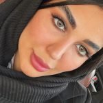 لنز دهب نچرال هیزل عسلی سبز - تصویر 3