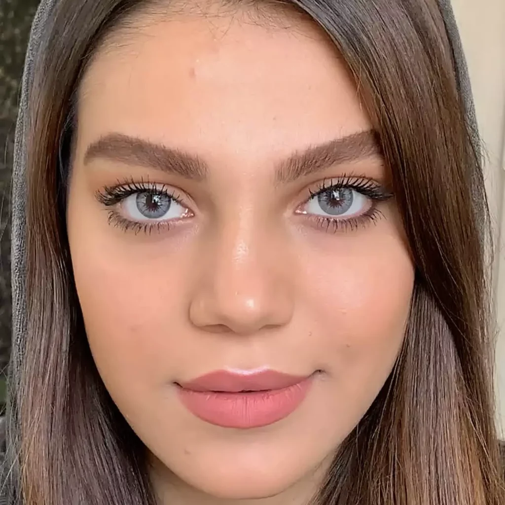 لنز جمستون کلاسیک آیس اسکای