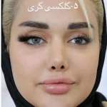 لنز سلنا گلکسی گری طوسی خاکستری رگه دار