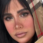 لنز جمستون اسپرینگ مل کلاسیک سبز عسلی دوردار - تصویر 8