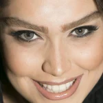 لنز پلی ویو گلدن یلو