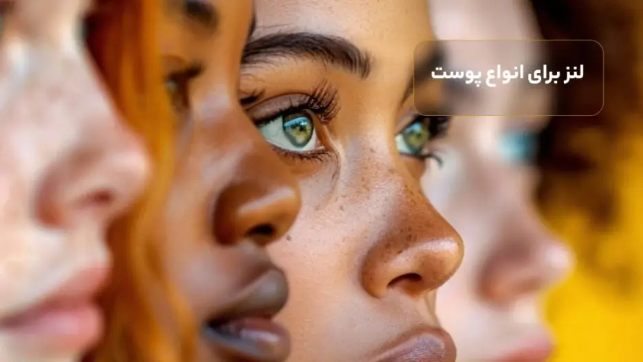 لنز برای انواع پوست